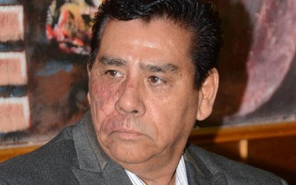 la-columna-hipotesis-de-acento-noticias.jpg La columna hipótesis de acento noticias