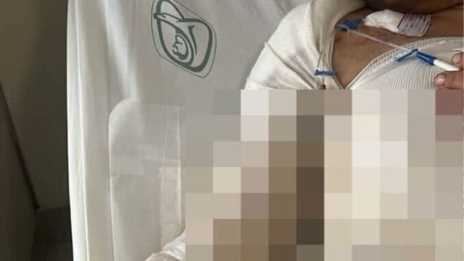 mujer-sobrevive-a-brutal-ataque-e-incendio-su-agresor-sigue-profugo.jpg Mujer sobrevive a brutal ataque e incendio; su agresor sigue prófugo